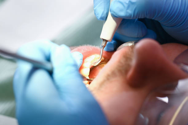 Best Broken Tooth Emergency  in Bronxville, NY